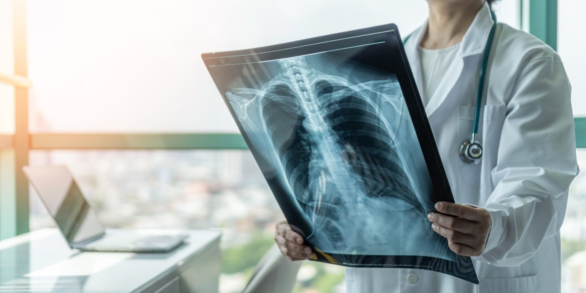 Cetățenii din raionul Ialoveni vor beneficia de examinări gratuite de screening pulmonar